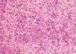 akvarell paint DS 15ml - 4050 Iridescent Vibrant Raspberry
